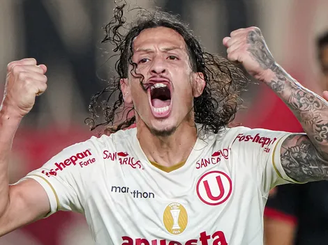 Preocupación en la 'U' tras operación de Riveros: ¿Qué tiempo estará de baja?