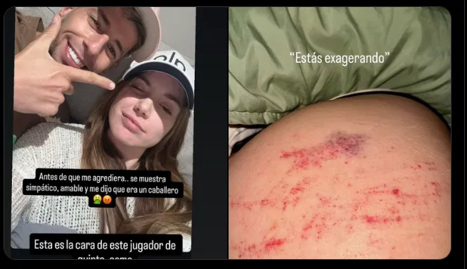 Fuente: @latiaboti.oficial2