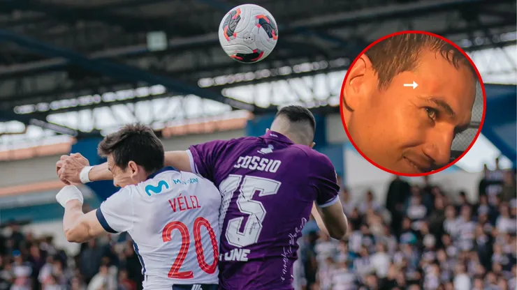Así quedó el rostro de Vélez tras penal no cobrado