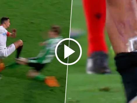 VIDEO | la temible patada que destrozó la pierna de Jesús Navas