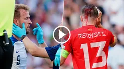 VIDEO | Kane protagonizó un durísimo choque de cabezas