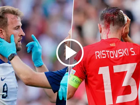 VIDEO | Kane protagonizó un durísimo choque de cabezas