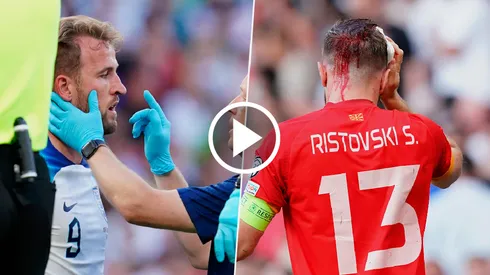 VIDEO | Kane protagonizó un durísimo choque de cabezas