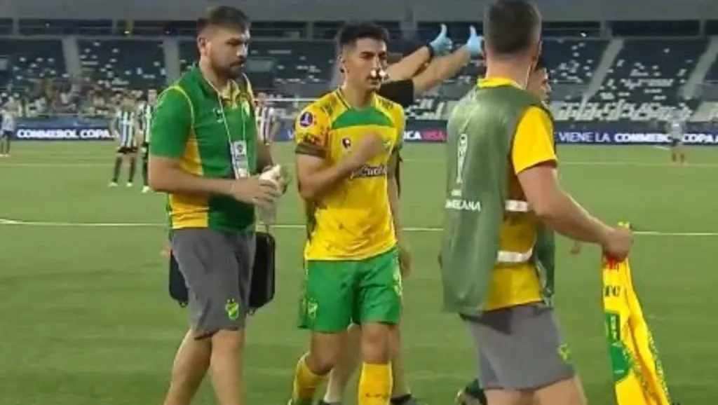 Así quedó Soto tras la patada a su rostro (Captura video)