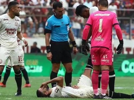 Malas noticias para la “U” contra Melgar