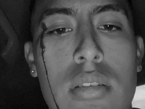 Hinchada de Sporting Cristal agrede a futbolista de Sport Boys por su casa