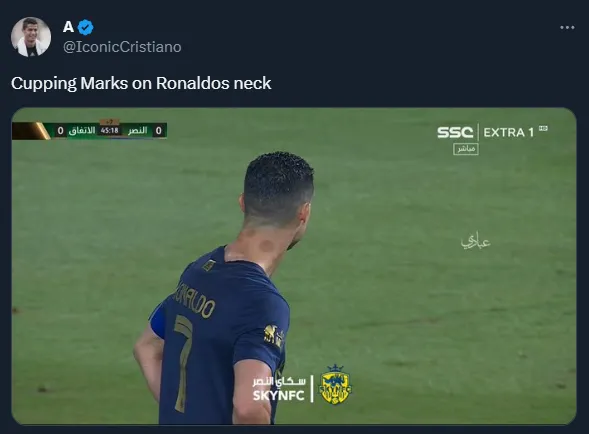 Cristiano Ronaldo, con manchas oscuras en la nuca (Twitter @IconicCristiano).
