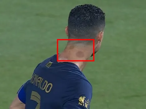 Las misteriosas manchas que mostró CR7 en su último partido, ¿a qué se deben?