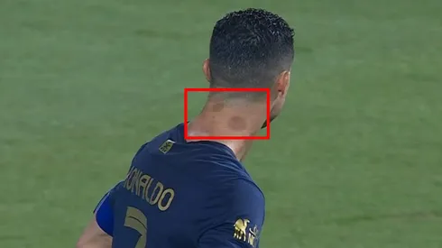 Cristiano Ronaldo y unas manchas particulares en la nuca.