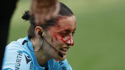 El accidente sufrido por la jueza Guadalupe Porras.