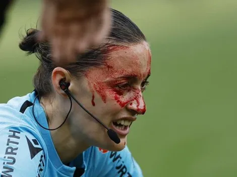 Insólito: el accidente que sacó del partido a una asistente en LaLiga