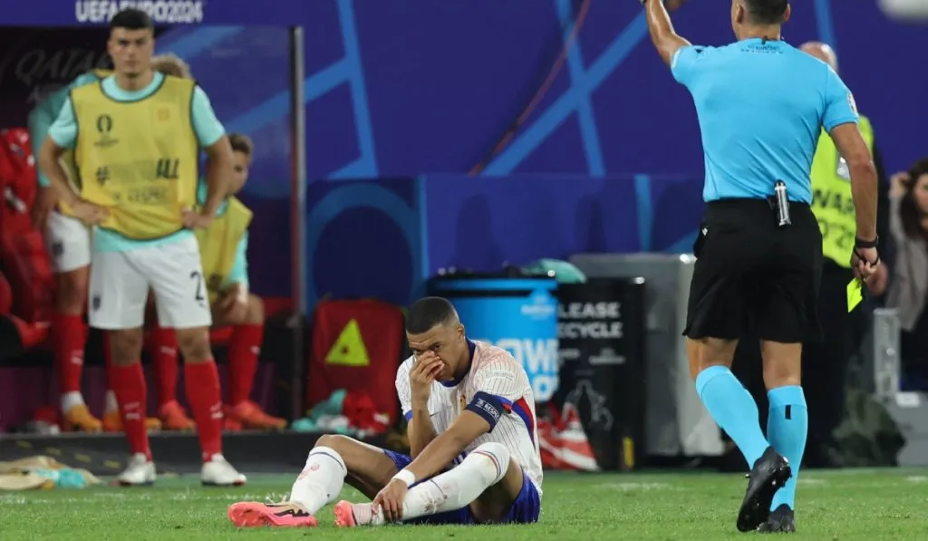 Mbappé en el momento de su fractura de nariz: IMAGO