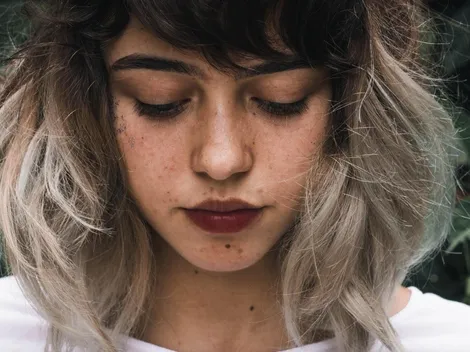 Por qué aparecen puntos y lunares rojos en la piel