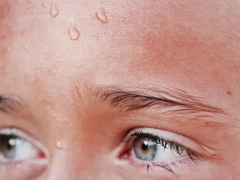 Descubre los tratamientos para el mal olor corporal y la sudoración excesiva