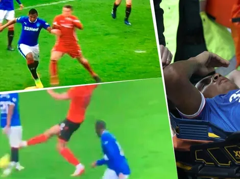 La herida que le causaron a Alfredo Morelos en Escocia