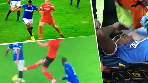 Así fue el golpe y la herida que sufrió Alfredo Morelos en Escocia.