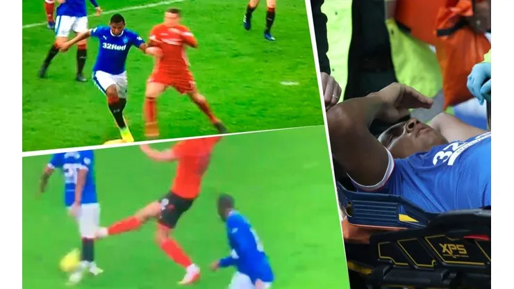 Así fue el golpe y la herida que sufrió Alfredo Morelos en Escocia.