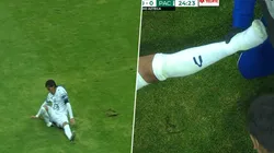 Impactante lesión del Burrito Hernández