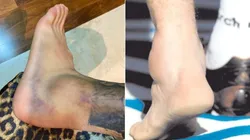 Los tobillos del Diente y Maradona