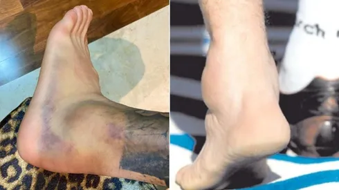 Los tobillos del Diente y Maradona