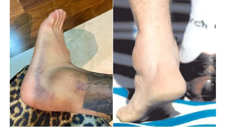 Los tobillos del Diente y Maradona