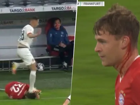A Kimmich le pisaron la cabeza, sangró y para el VAR no fue nada
