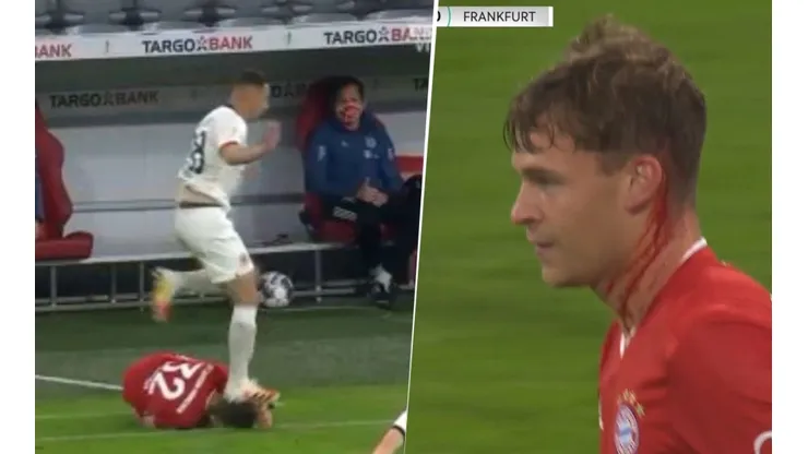 A Kimmich le pisaron la cabeza, sangró y para el VAR no fue nada