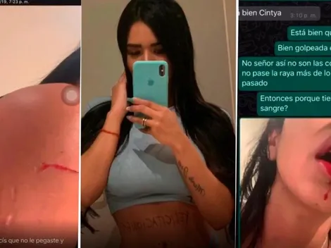 Con más fotos y audios de maltrato, ex de Villa lo acusa de adulterar pruebas