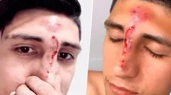 Alan Pulido sufrió un accidente.