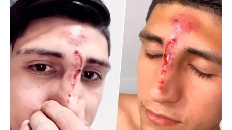Alan Pulido sufrió un accidente.