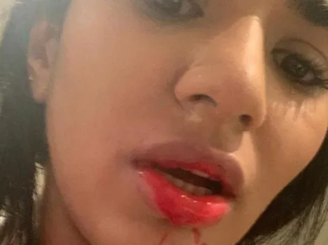 Terrible: Daniela Cortés dijo que perdió un embarazo debido a los golpes de Villa