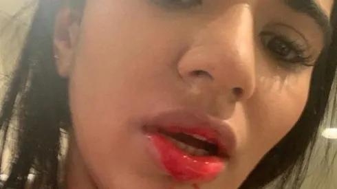 El rostro ensangrentado de Daniela Cortés.