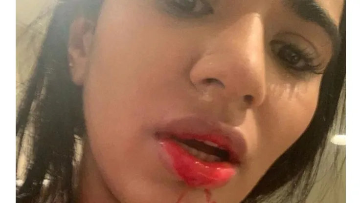 El rostro ensangrentado de Daniela Cortés.