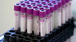 El número de pruebas de Coronavirus que se necesitaría para que regrese la temporada