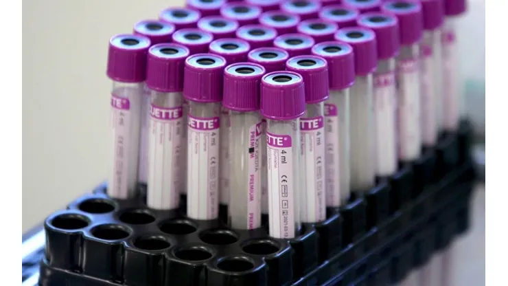 El número de pruebas de Coronavirus que se necesitaría para que regrese la temporada