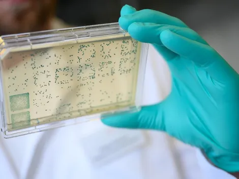 Orgullo nacional: U. de Antioquia logra aislar el virus y esperar encontrar la cura