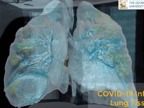 Video en 3D muestra como es que el Coronavirus ataca los pulmones