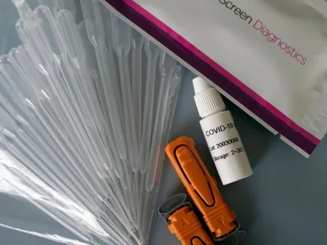 Cancelan compra de pruebas de coronavirus en Jalisco