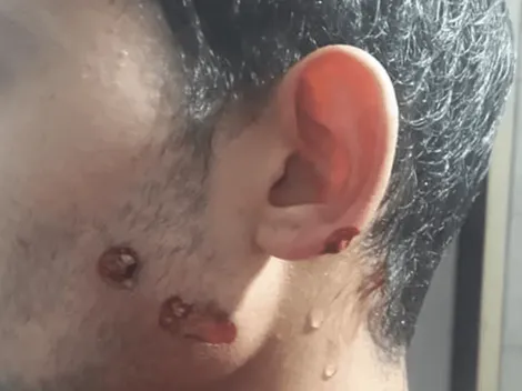 La Pampa: salió a comprar pan y le dispararon en la cara