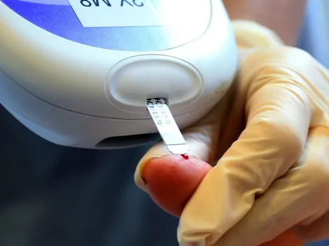 Fallece por Coronavirus persona con obesidad y diabetes