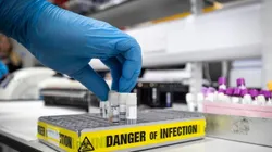 En EEUU aprueban la primera prueba rápida para detectar Coronavirus