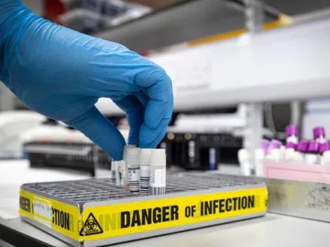 En EEUU aprueban la primera prueba rápida para detectar Coronavirus