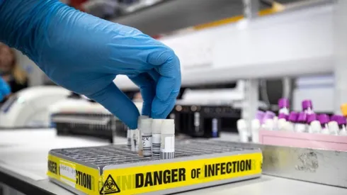 En EEUU aprueban la primera prueba rápida para detectar Coronavirus