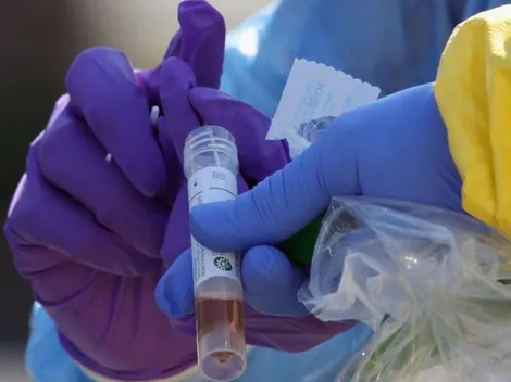 Estados Unidos: Se autoriza una prueba que podría detectar el coronavirus en 45 minutos