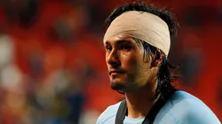 Foto impactante: Pachuca reveló cómo quedó la ceja de Jorge Hernández