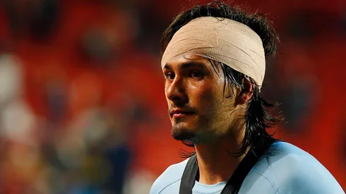 Foto impactante: Pachuca reveló cómo quedó la ceja de Jorge Hernández