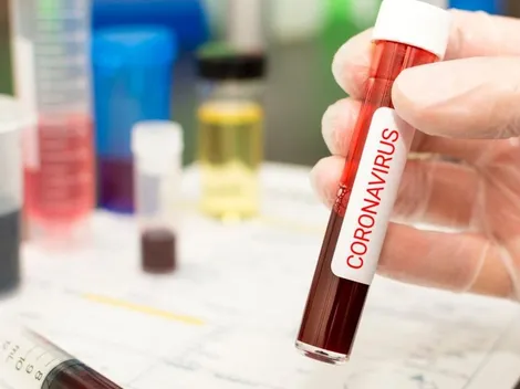 Se elevan a 22 los casos confirmados por Minsalud de Coronavirus en Colombia