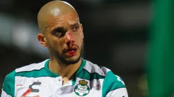 Doria trolleó a Torres tras operación en su nariz