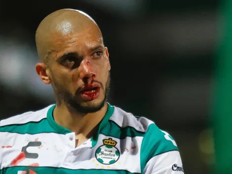 Doria trolleó a Torres tras operación en su nariz