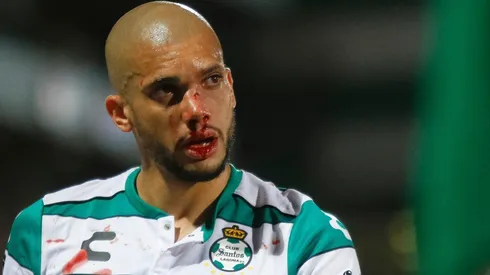 Doria trolleó a Torres tras operación en su nariz